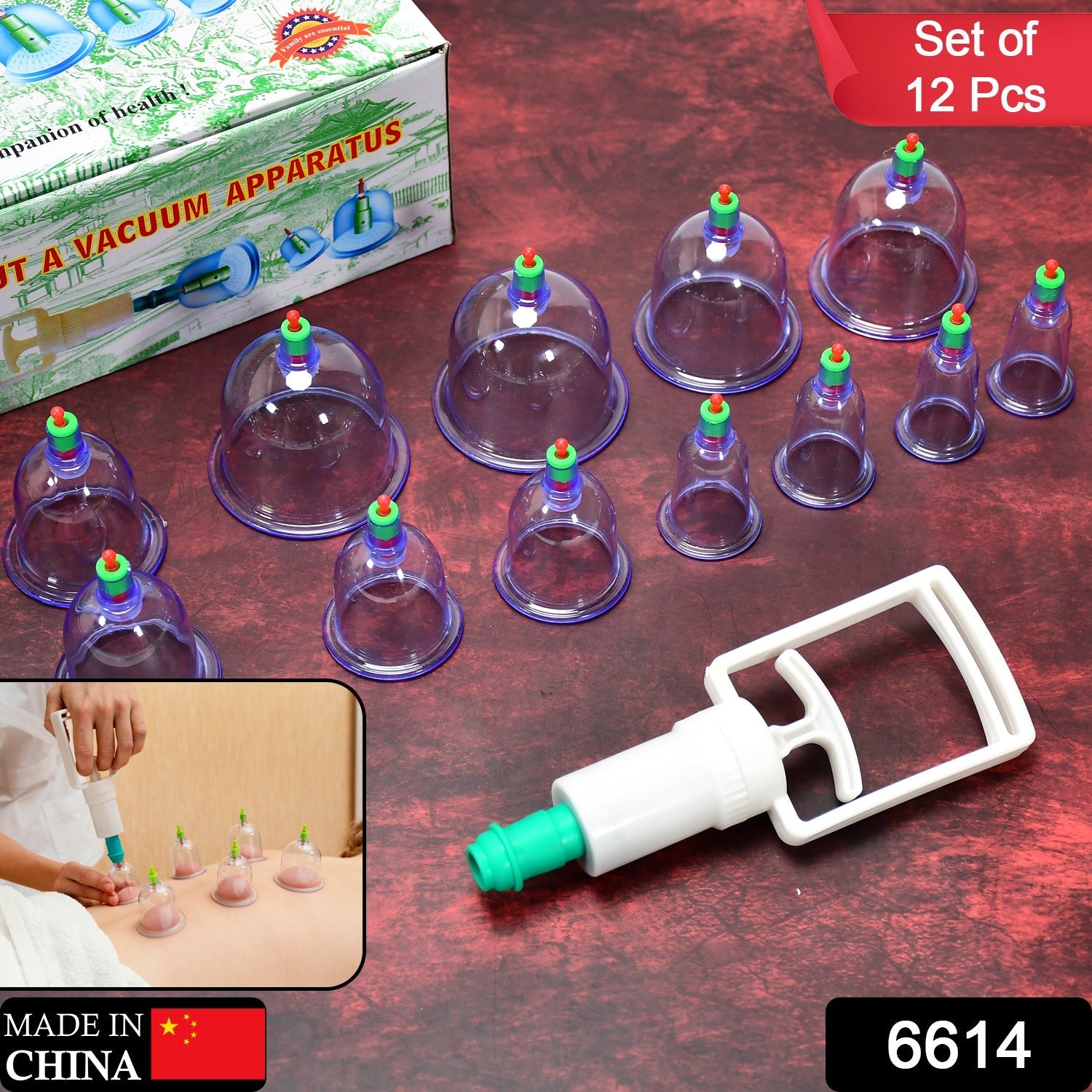 Vacuum cupping kit for relaxation and therapy. Vacuum cupping kit for relaxation and therapy.